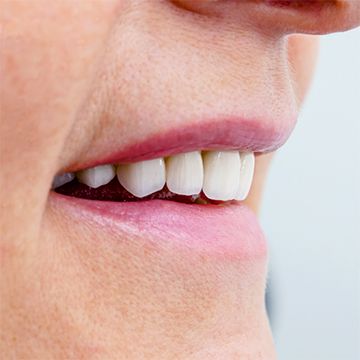 Циркониевые коронки на передние зубы 