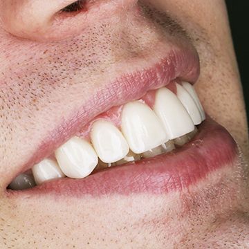 В какой клинике или поликлинике делать зубы